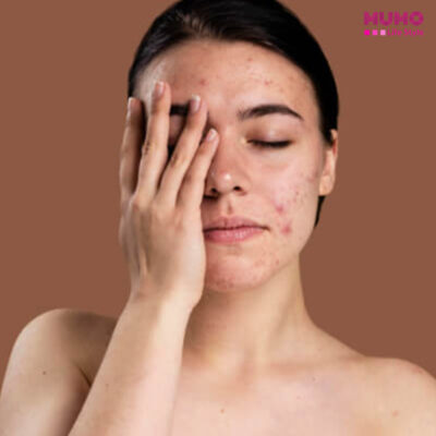 সেনসিটিভ ত্বকের জন্য কোন ময়েশ্চারাইজার বেছে নেবেন