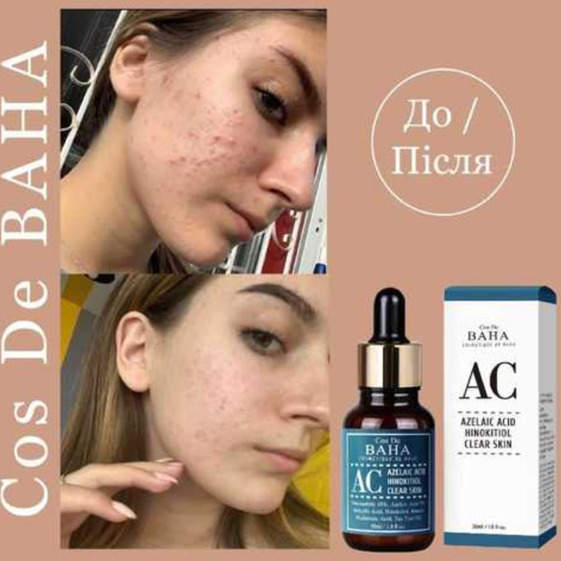 Cos De Baha Acne Clearing Serum (Acne Treatment) Ac 30ml - Image 3