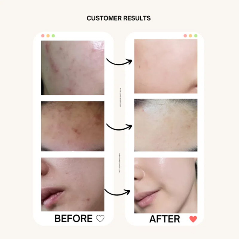 Beauty Of Joseon Sunscreen: Rice + Probiotics Spf 50+ Pa++++ (50ml) - Image 3