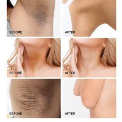 Alternative view of 3W Clinic Underarm Whitening Multi Cream 100g