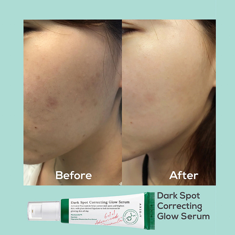AXIS-Y Dark Spot Correcting Glow Serum 50 ml - Image 2