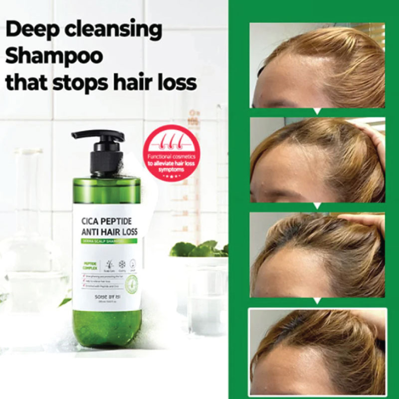 HTS Anti Hair Loss Scalp Tonic 150ml - Image 3