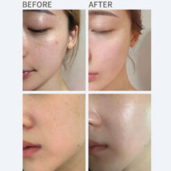 Alternative view of Heimish All Clean Vitamin Blemish Spot Clear Cream 10ml (mini)