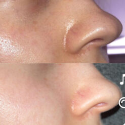 Alternative view of Isntree Hyaluronic Acid Toner Plus 20 ml