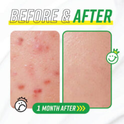 Alternative view of JUMISO Have A Good Cream Snail & Centella 50g (In Bangladesh)